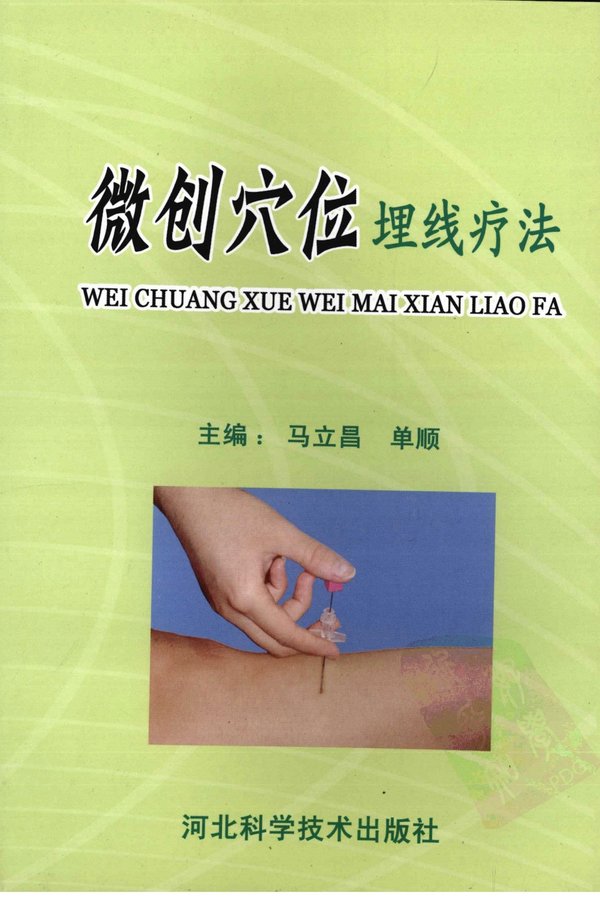 6sHNTzXu.jpg